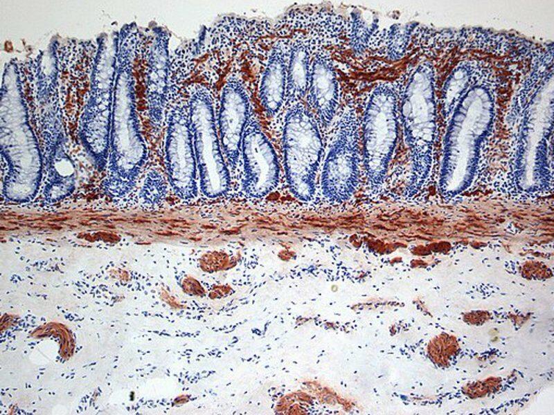 1590372694_548px-hirschsprung_acetylcholine-3397801